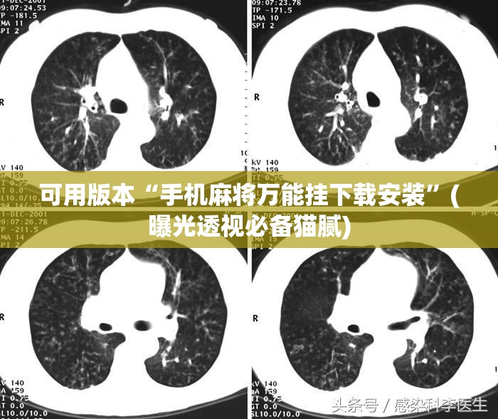 可用版本“手机麻将万能挂下载安装”(曝光透视必备猫腻)