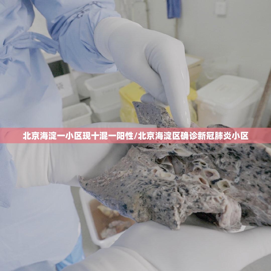 防疫政策最新规定(防疫政策本地宝)