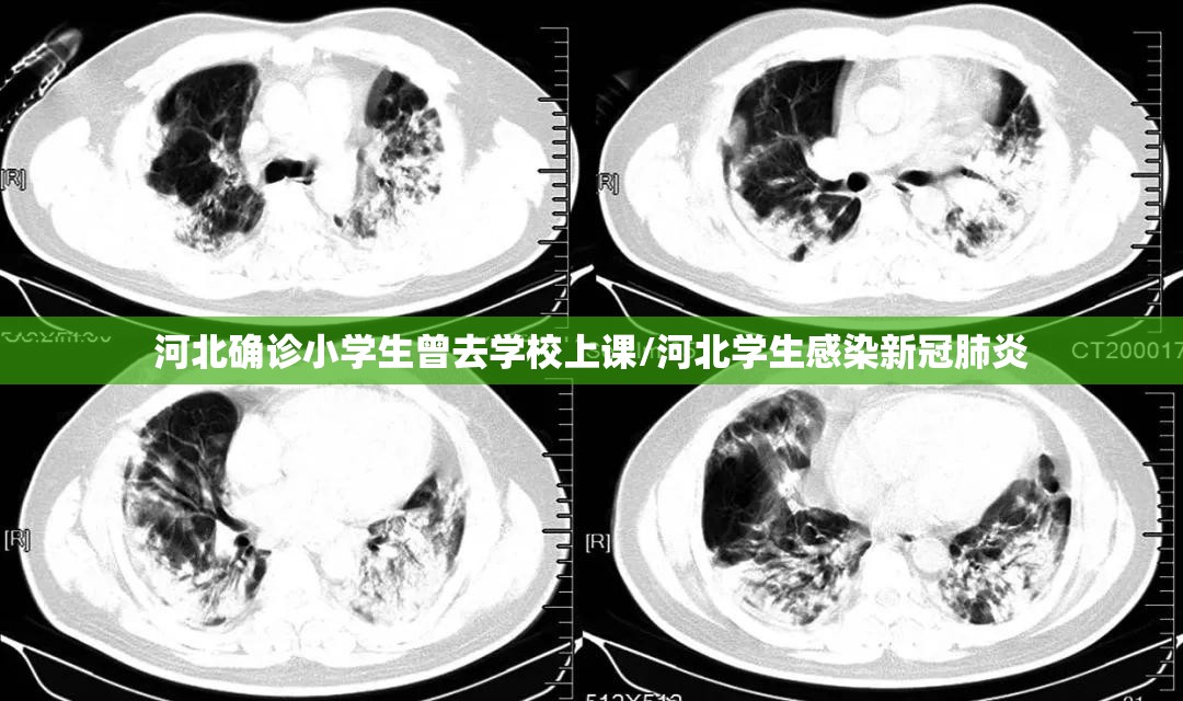 安徽确诊病例(安徽确诊病例在京密接28人)