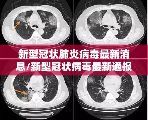 【浙江新增16例本土无症状，浙江新增5】