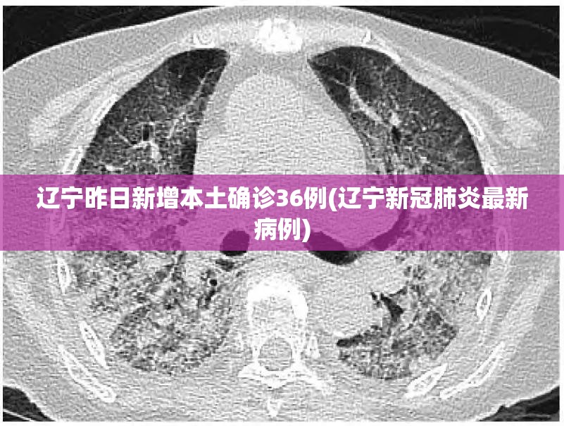 【北京疫情查询，北京疫情防控最新消息】